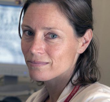 Neurologist Tanzania 